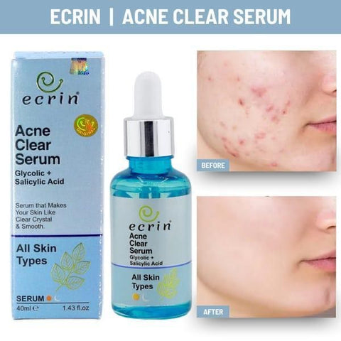 Acne Clear Serum - 40ml