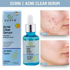 Acne Clear Serum - 40ml